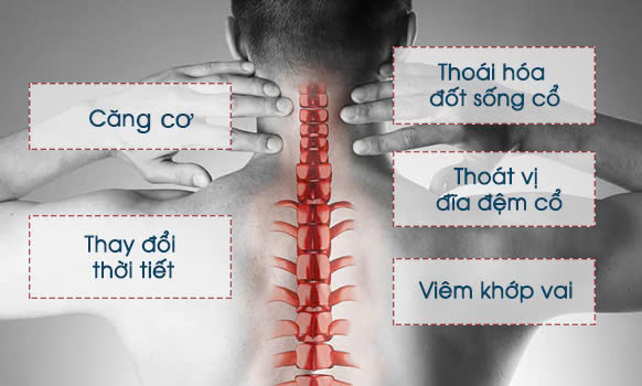 Điều Trị Đau Thần Kinh Tọa